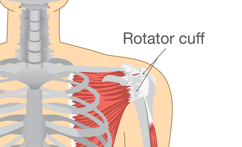 The rotator cuff is a group of four muscles that surround the shoulder joint 
